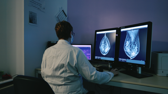 이탈리아 트레비소주 유방암 검진 프로그램 책임자인 클라우디아 바이스 박사가 루닛 AI 유방암 진단 솔루션 '루닛 인사이트 MMG'를 활용해 유방촬영 영상을 분석하고 있다.(사진=루닛)
