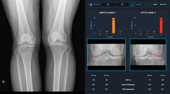 [2025 4차산업 Power Korea 대전]크레스콤-보건복지부 장관상