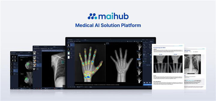 마이허브, 뷰노 골연령 분석 솔루션 인수...'마이:본에이지'로 탈바꿈 - 뉴스 썸네일 이미지