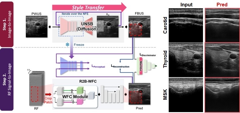 평면파 초음파의 낮은 영상 화질 문제를 해결하기 위해 신호 단계에서부터 고품질 영상을 재구성할 수 있는 딥러닝 기반 프레임워크와 결과 이미지