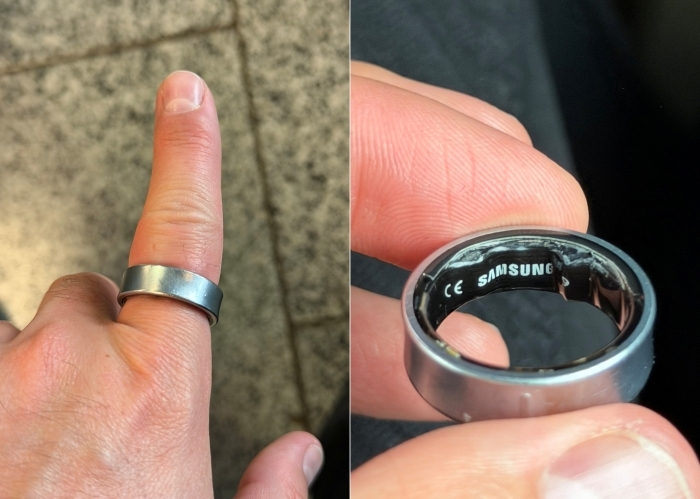 갤럭시링 배터리부분이 부풀어 올라 손가락을 압박하고 있는 모습. 사진=엑스(@ZONEofTECH) 캡처