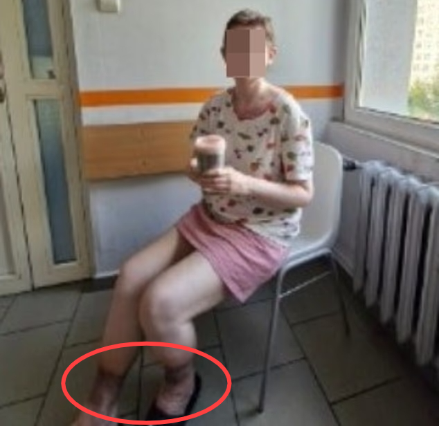27년전 실종된 소녀, 부모와 집에 있었다... “괴사한 듯 다리 퉁퉁 부어”