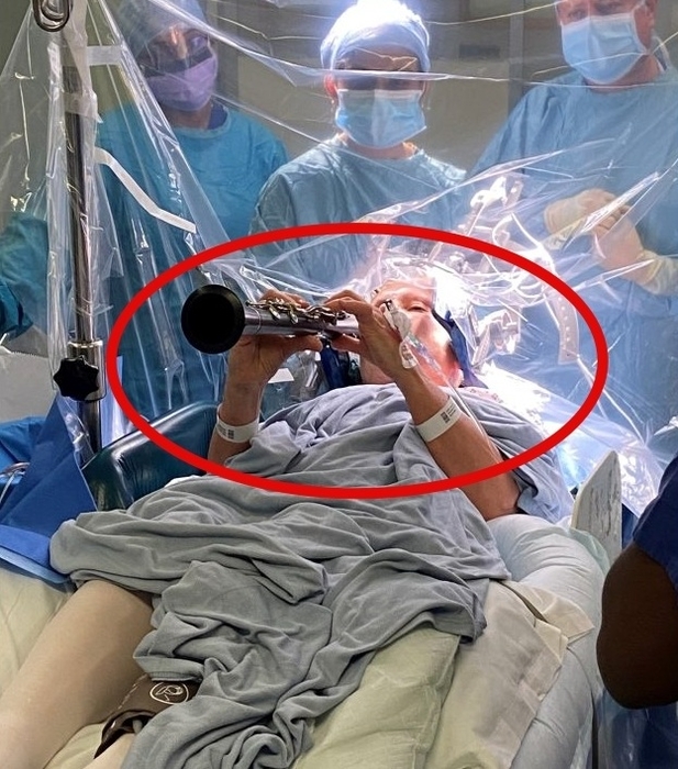 英 수술실에 울려 퍼진 클라리넷 연주…뇌수술 중 무슨 일?