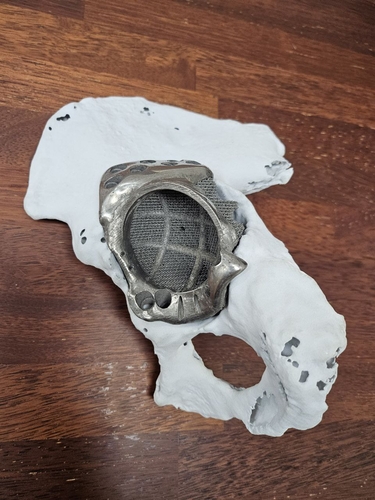 골대체 융합의료기기.