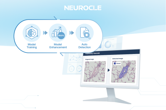 뉴로클, 대한병리학회 추계학술대회 참가...디지털 병리학 위한 AI 소프트... - 뉴스 썸네일 이미지