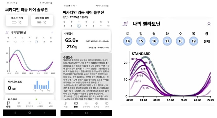 멜라토닌 리듬 곡선 진단 앱. 사진=써카디언