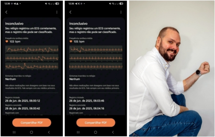 갤럭시워치를 착용한 호베르투 갈라르트와 심전도 측정 데이터. 사진=연합뉴스