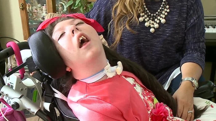 '뇌 없이' 태어난 美 여성, 20번째 생일 맞았다