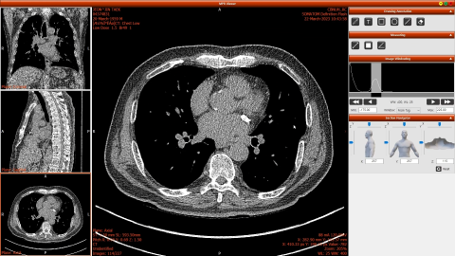 엑스큐브, 의료영상 분석 솔루션 'HEXA Pro'