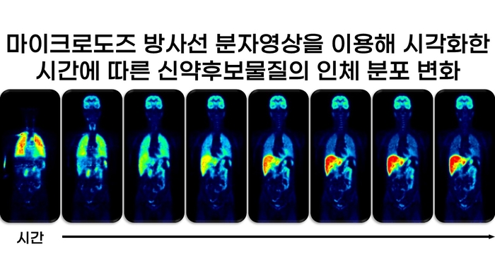 몰림, 마이크로도즈 방사성 분자영상 기술로 예측 정확도 높인다 - 뉴스 썸네일 이미지
