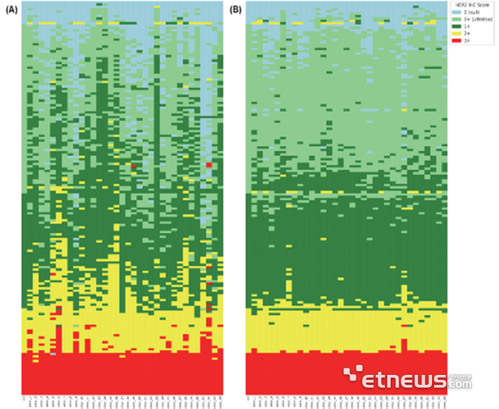 HER2 IHC 판독에서 AI 보조 전(왼쪽)·후(오른쪽) 병리 전문의 판독 결과 비교.