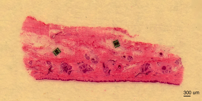 피부 조직 단면 위에 놓인 마이크로로봇 / Maya Lassiter, University of Pennsylvania