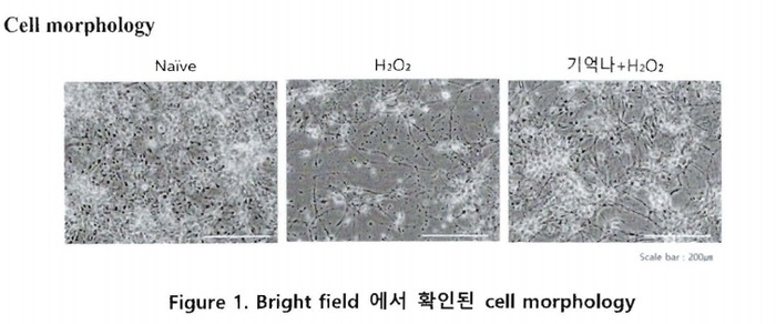 산화 스트레스 환경에서의 신경세포 형태 변화 비교. (사진 왼쪽부터) 정상 대조군, 과산화수소(H₂O₂)로 산화 스트레스를 유발해 신경돌기가 소실된 부형 대조군, '기억나(BR-1)' 선처리 후 산화 스트레스 환경에서도 세포 수와 신경돌기 구조가 보존된 실험군의 현미경 관찰 모습.