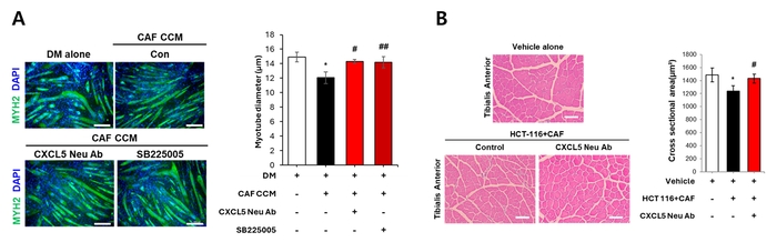 세포 및 동물 모델에서의 CAF 유래 CXCL5 타깃 암 악액질 치료 효능 검증.