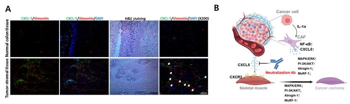 대장암 환자 조직 분석을 통한 임상적 검증(A) 및 암 악액질 치료 기전 모식도(B).