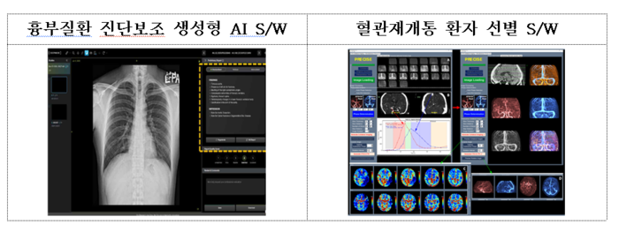 딥노이드의 생성형 AI 기반 흉부 질환 진단 보조 소프트웨어(왼쪽)와 딥클루의 허혈성 뇌혈관 질환 환자 선별 SW(자료=식품의약품안전처)