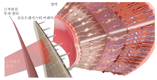 근적외선 감지 인공망막의 구조 및 이식 개념도. (박장웅 교수)