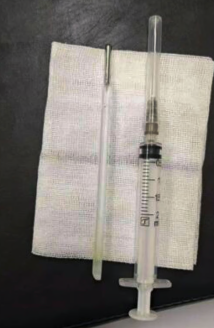 복부 통증을 호소하며 병원을 찾은 중국인 남성의 몸속에서 약 20년 전 삼킨 것으로 추정되는 수은 체온계가 발견돼 화제가 되고 있다. 사진=SCMP