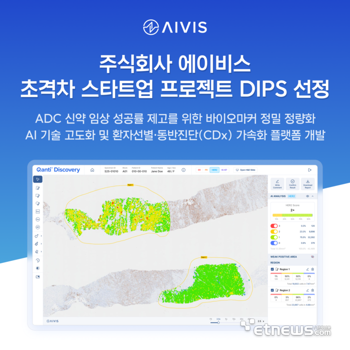 에이비스, '초격차 스타트업 1000+' 선정…ADC 신약 개발 겨냥 바이오마커 정량분석 AI 고도화