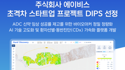 기사 썸네일