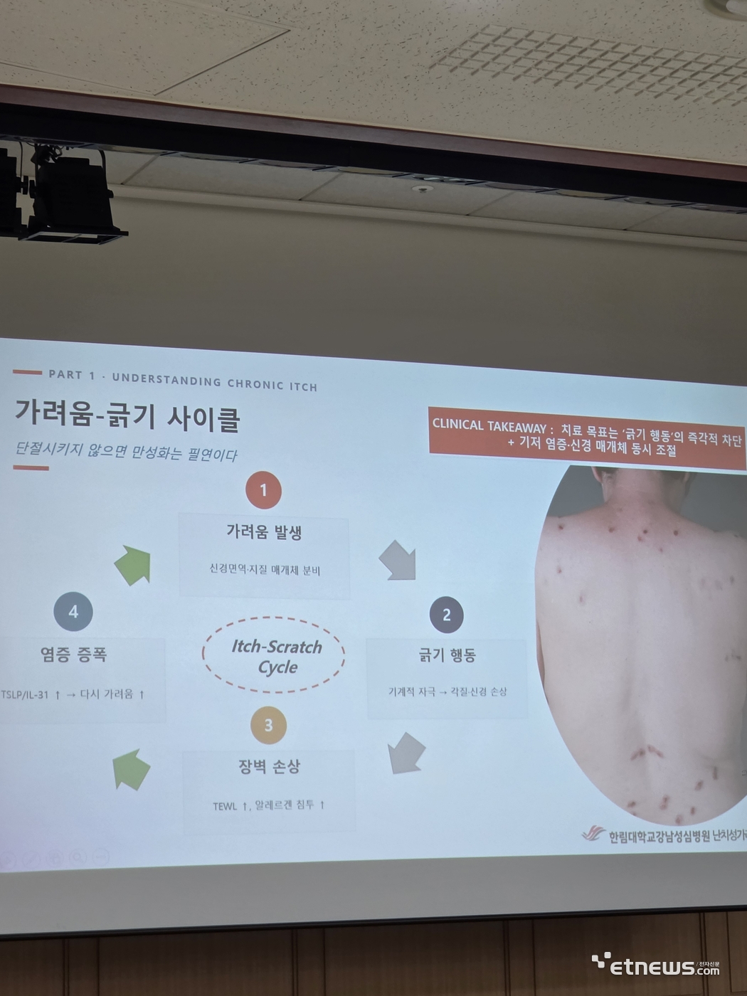 가려움증 환자가 반복해 피부를 긁으면 피부 장벽과 신경 말단이 손상되며 염증 반응이 증폭되는 '가려움-긁기 사이클(Itch-Scratch Cycle)' 인포그래픽.