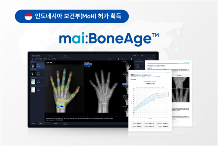의료 인공지능(AI) 플랫폼 기업 마이허브가 인도네시아 법인 설립과 골연령 분석 솔루션 '마이본에이지'의 허가를 마치며 동남아시아 시장을 본격 공략한다.(사진=마이허브)
