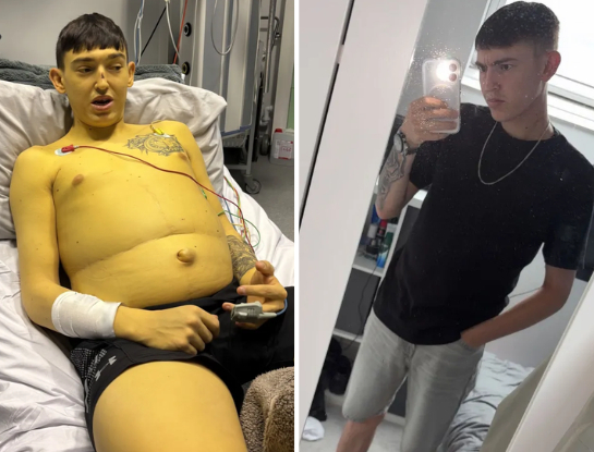 희귀 간 질환으로 피부가 노랗게 변한 남성. 사진=더 선
