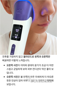 풀써마프로를 사용중인 모습(위)과 챗GPT가 답변한 기기 사용 전후 사진 비교.