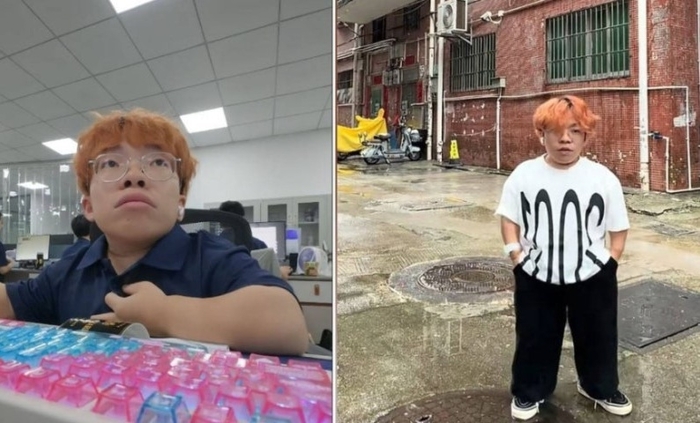 유전적 돌연변이로 키가 1.08m에서 멈춘 츠츠베이신. 사진=홍콩 더 스탠다드