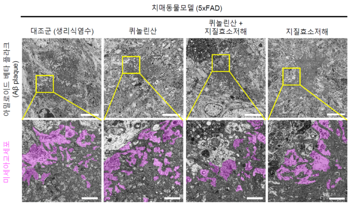 연구진은 퀴놀린산에 의한 미세아교세포 활성화 및 아밀로이드베타 제거 효과를 확인했다.