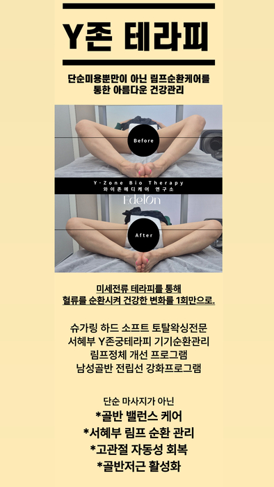 Y 존 테라피 이미지.