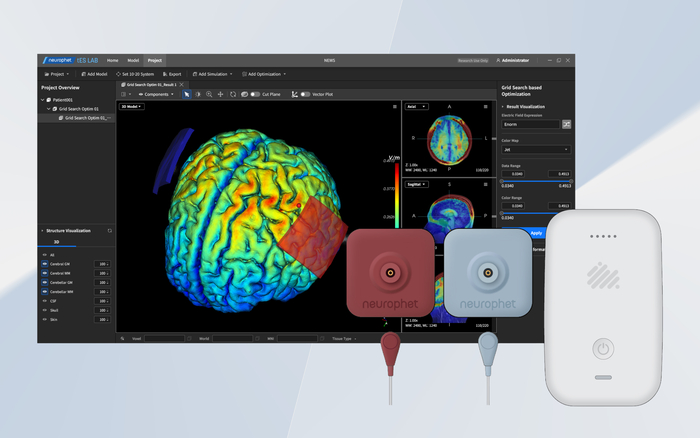 뉴로핏의 개인 맞춤형 경두개직류자극술(tDCS) 솔루션.(제공=뉴로핏)