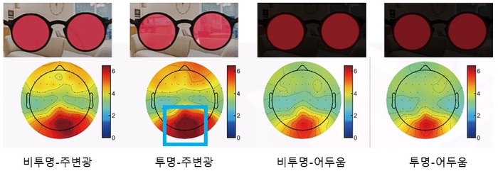 투명-비투명 OLED 안경과 주변광 유무를 조합한 네 가지 조건서 감마 진동수 빛 자극 결과 (자료=분당서울대병원)