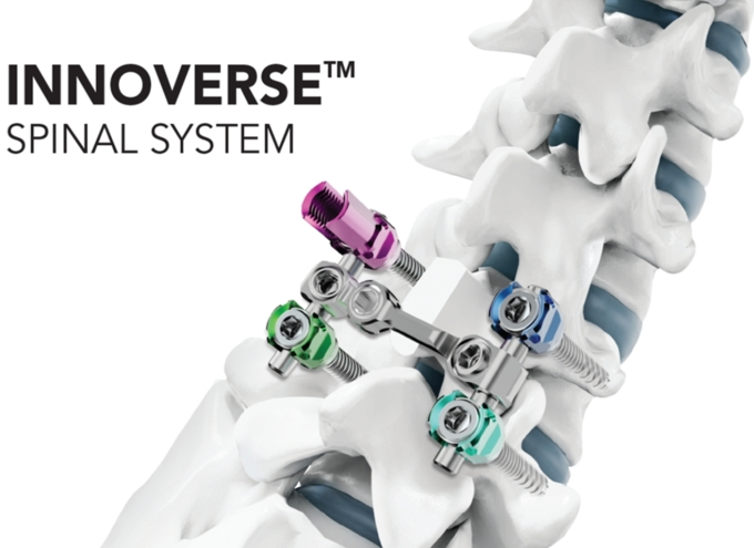 시지메드텍의 척추 고정 장치 '이노버스 스파이널 시스템(INNOVERSE Spinal System)' 이미지.(제공=시지메드텍)