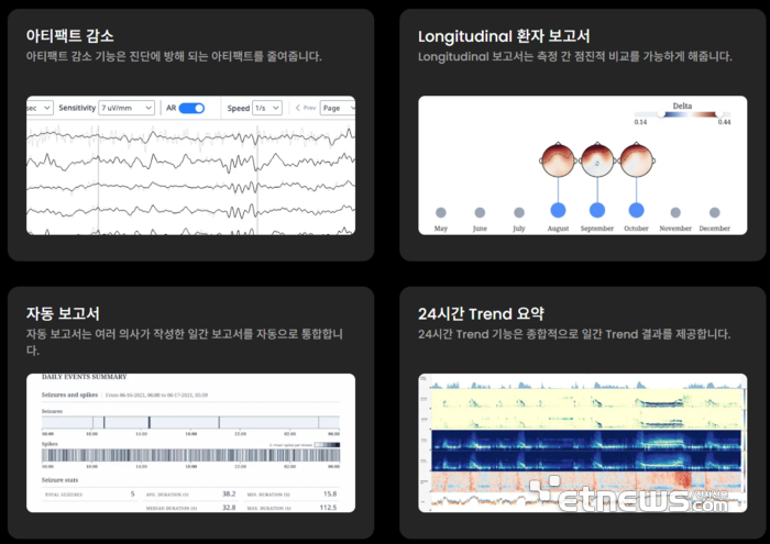 뉴로매치의 주요 기능[엘브이아이에스코리아 홈페이지]