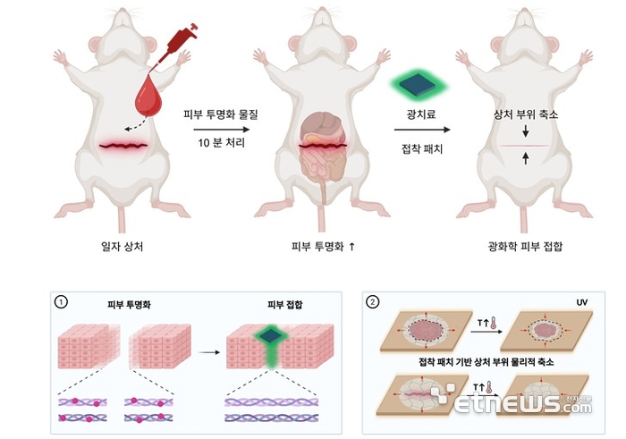 광학적 피부 투명화를 이용한 광화학 조직 접합용 발광 접착 패치 모식도