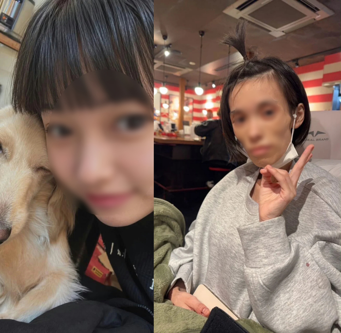 일본 경찰 구금 이후 섭식장애를 겪다 숨진 루나(가명). 구금 전 모습(왼쪽)과 구금 이후 야윈 모습. 사진=CNN 캡처