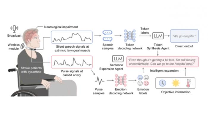 입만 벙긋해도 AI가 통역… 뇌졸중 환자의 '침묵을 깬' 목걸이