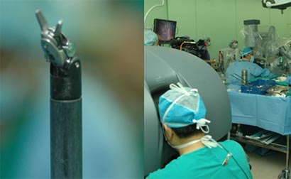 "이젠, 로봇이 수술하네요!"