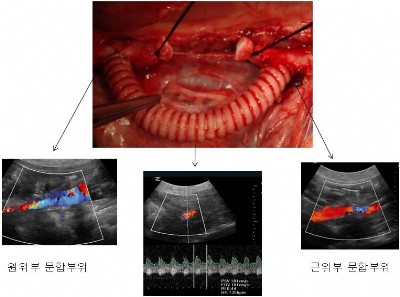 생기원, 재료비의 2500배 인공혈관 섬유 개발