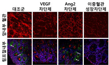 폐암 모델에서 이중혈관성장차단제의 의한 폐암내부의 혈관성장 억제와 림프절로의 암전이 억제효과가 VEGF나 Ang2 단독 차단제에 비해 우수함을 나타내는 결과 (빨간색 : 혈관, 녹색 : 림프절로 전이된 암세포)