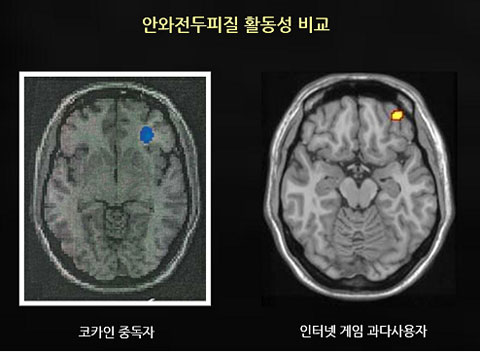 이제 중학생 3시간 게임하면 강제종료 시킨다? 청소년 연령대별 게임시간 제한 갑론을박