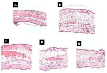 염증을 일으킨 실험용 쥐의 귀 피부를 대상으로 실험한 모습. A그림은 아무런 처리를 하지 않은 피부이며, B와 C그림은 기존 화학물로 처리한 피부이다. D와 E그림은 식물 유래 천연물로 피부 염증을 치료한 모습인데, 화학물로 처리한 B와 C, 천연물인 유제놀로 처리한 D보다도 대추씨 유래 천연물로 처리한 피부가 치료효과가 높은 모습을 볼 수 있다.
