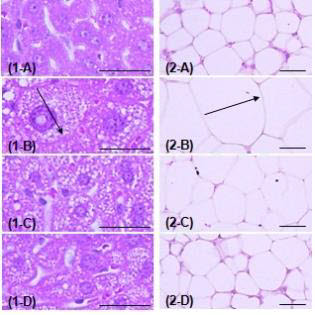 1-A는 정상 쥐의 간, 2-A는 지방세포 조직이다. 1- B는 비만 쥐의 간과 지방세포 조직(2-B)이고 C와 D는 2주~3주동안 정유를 흡입한 간과 지방세포 조직으로 세포 조직의 크기가 현격히 줄어든 모습을 볼 수 있다.
