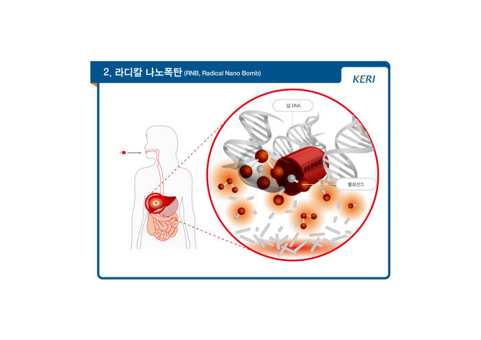 라디칼 나노캡슐은 활성산소분자를 암조직 주변에 퍼트려 강력한 산화작용으로 암세포를 제거하는 첨단 기술기술이다.