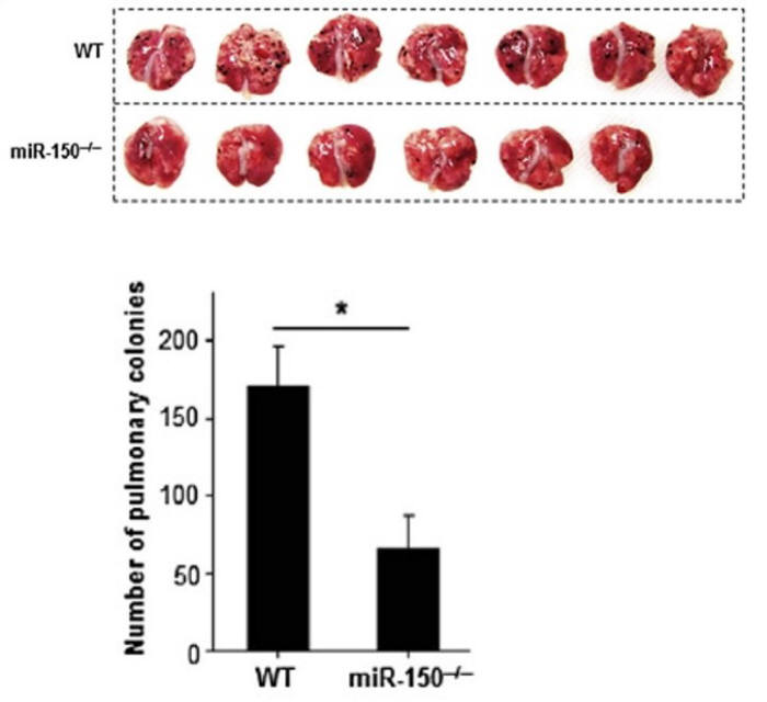 동물 실험 결과, miR-150이 제거된 NK세포가 정상 세포보다 더 효과적으로 흑색종양 증식, 전이를 막았다.