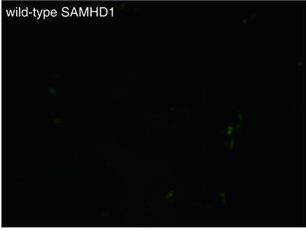 HIV-1을 형광단백질로 표지한 결과, SAMHD1 분해효소 기능이 정상적으로 발현되는 세포(좌)에서는 HIV-1 증식이 억제된 반면, 분해효소 기능이 발현되지 않은 세포(우)에서는 HIV-1 증식이 진행됐다.