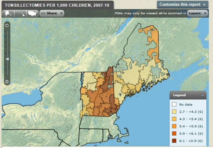 미국 뉴잉글랜드 북부의 편도 절제술 현황을 지역별로 보여주는 다트머스 아틀라스 화면.