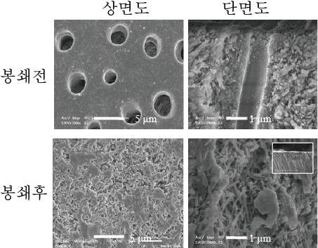 고려대 치과 전상호 교수팀, 시린이 극복하는 치료제 개발