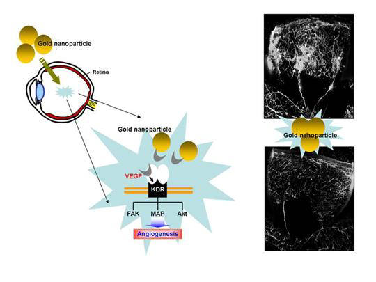 금 나노입자가 망막에서 신생혈관을 억제하는 모습.